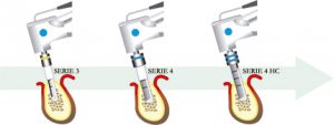Tecnica quirurgica implante dental paso 4 ejemplo hc