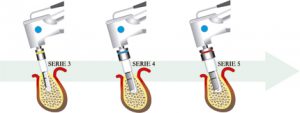 Tecnica quirurgica implante dental paso 4 ejemplo implante 510