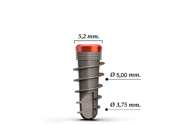 Implante IA511.5 - Imagen 2
